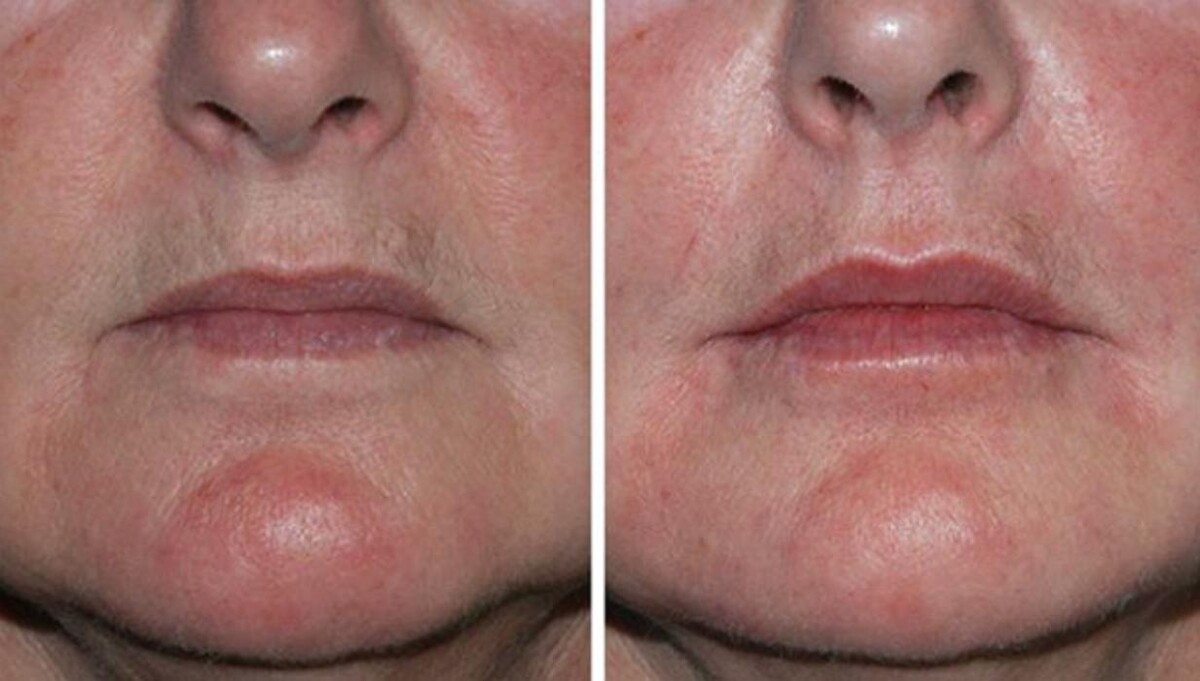 Images Eugenie Brunner, MD, FACS