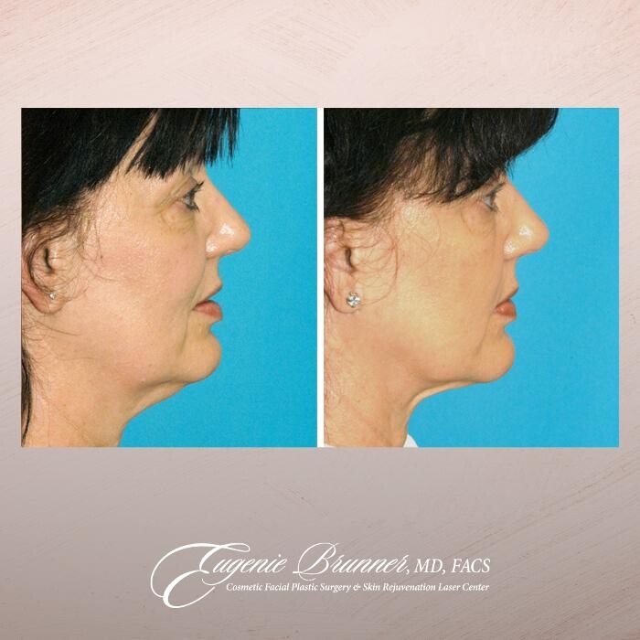 Images Eugenie Brunner, MD, FACS