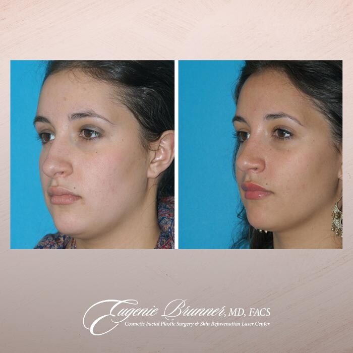 Images Eugenie Brunner, MD, FACS