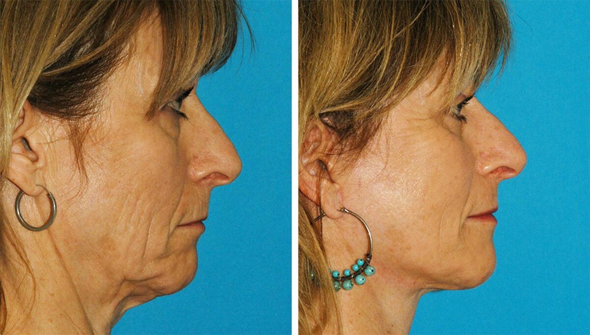 Images Eugenie Brunner, MD, FACS