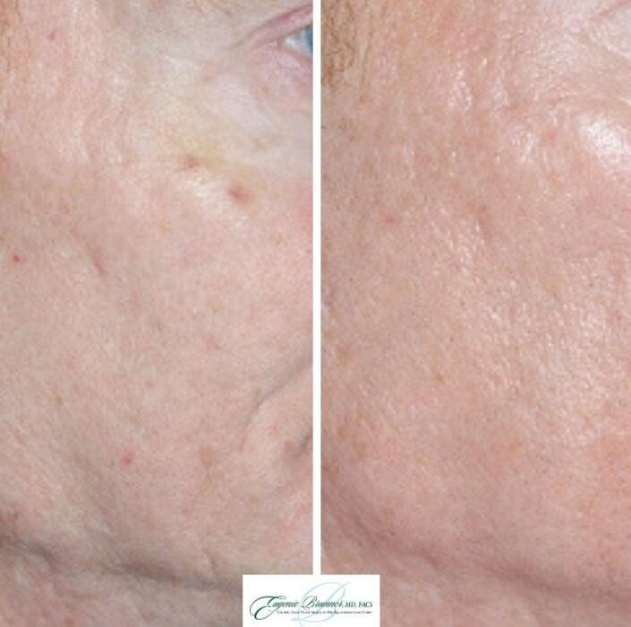 Images Eugenie Brunner, MD, FACS