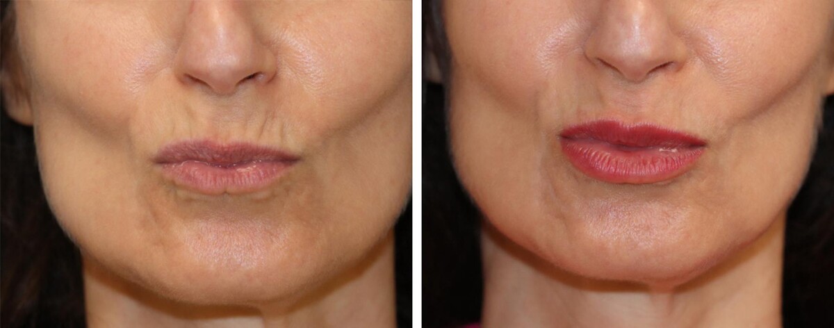 Images Eugenie Brunner, MD, FACS