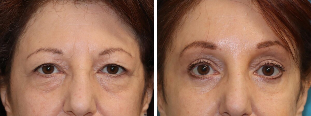 Images Eugenie Brunner, MD, FACS