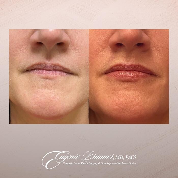 Images Eugenie Brunner, MD, FACS