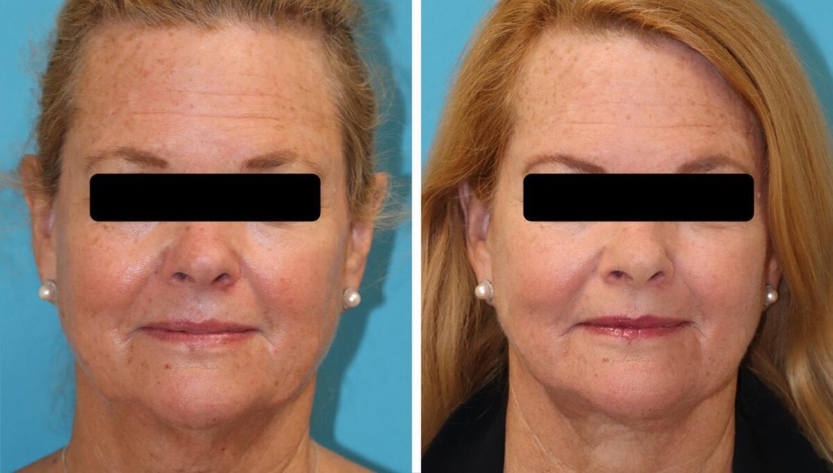 Images Eugenie Brunner, MD, FACS