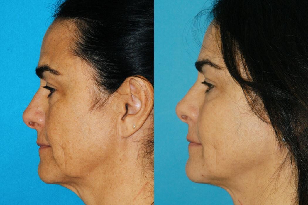 Images Eugenie Brunner, MD, FACS