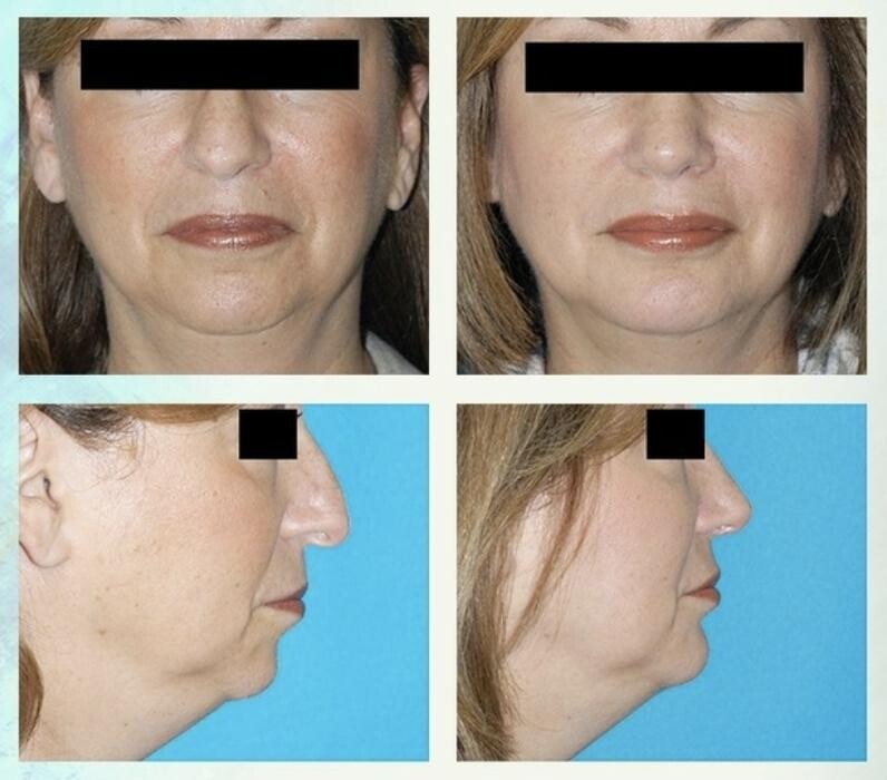 Images Eugenie Brunner, MD, FACS