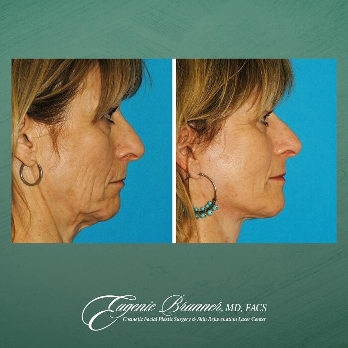 Images Eugenie Brunner, MD, FACS