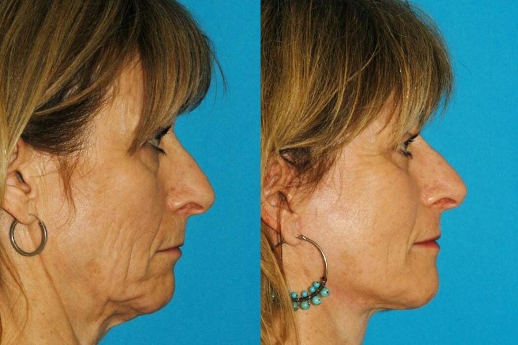 Images Eugenie Brunner, MD, FACS