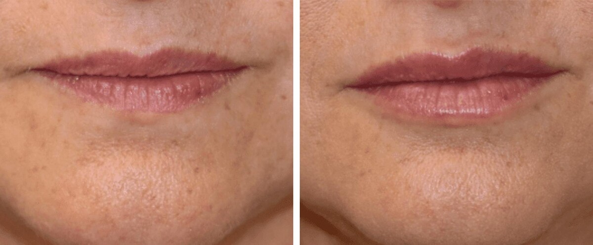 Images Eugenie Brunner, MD, FACS