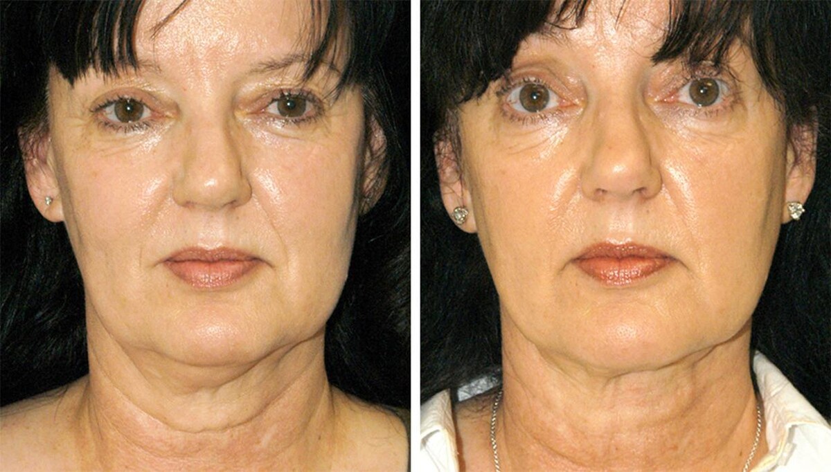 Images Eugenie Brunner, MD, FACS