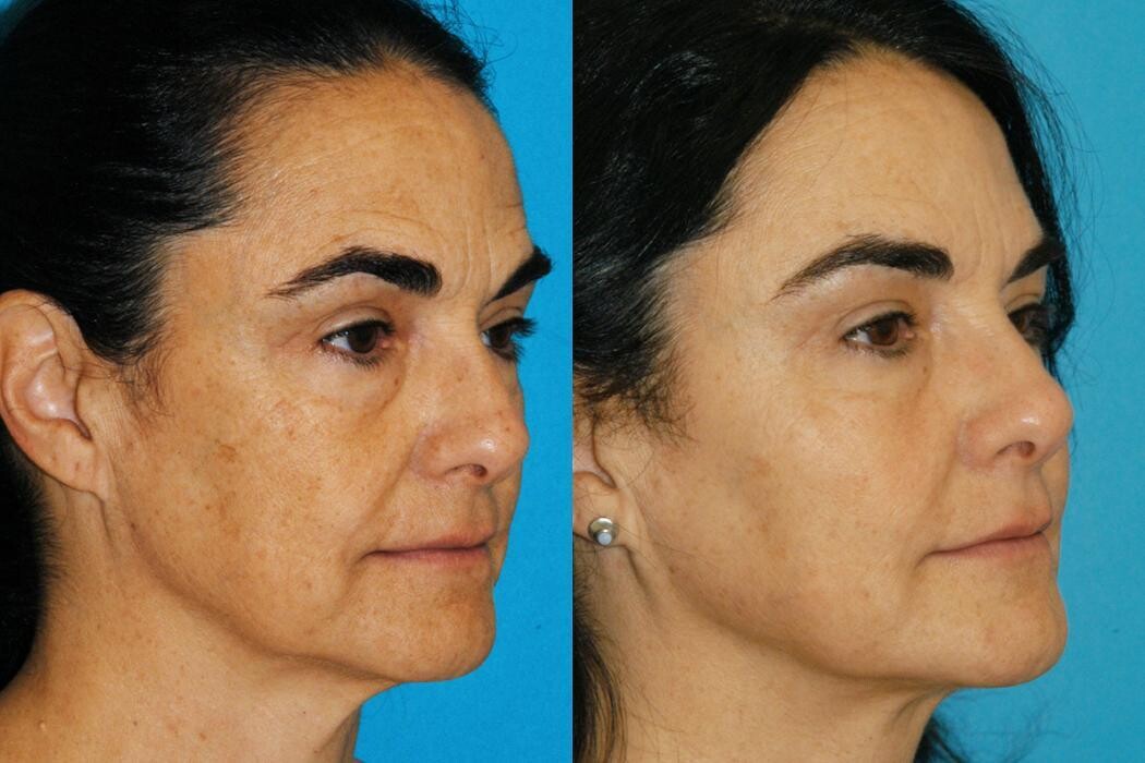 Images Eugenie Brunner, MD, FACS