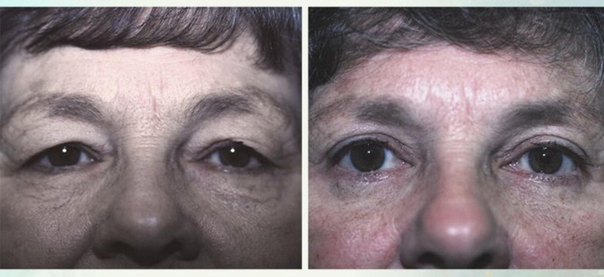 Images Eugenie Brunner, MD, FACS