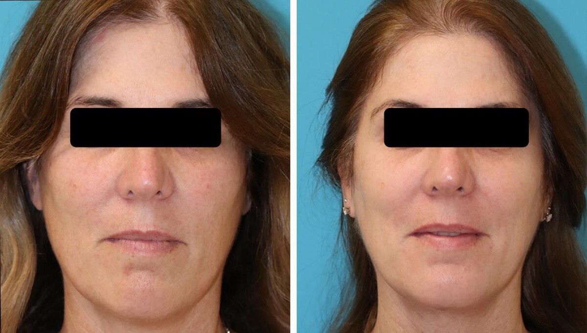 Images Eugenie Brunner, MD, FACS