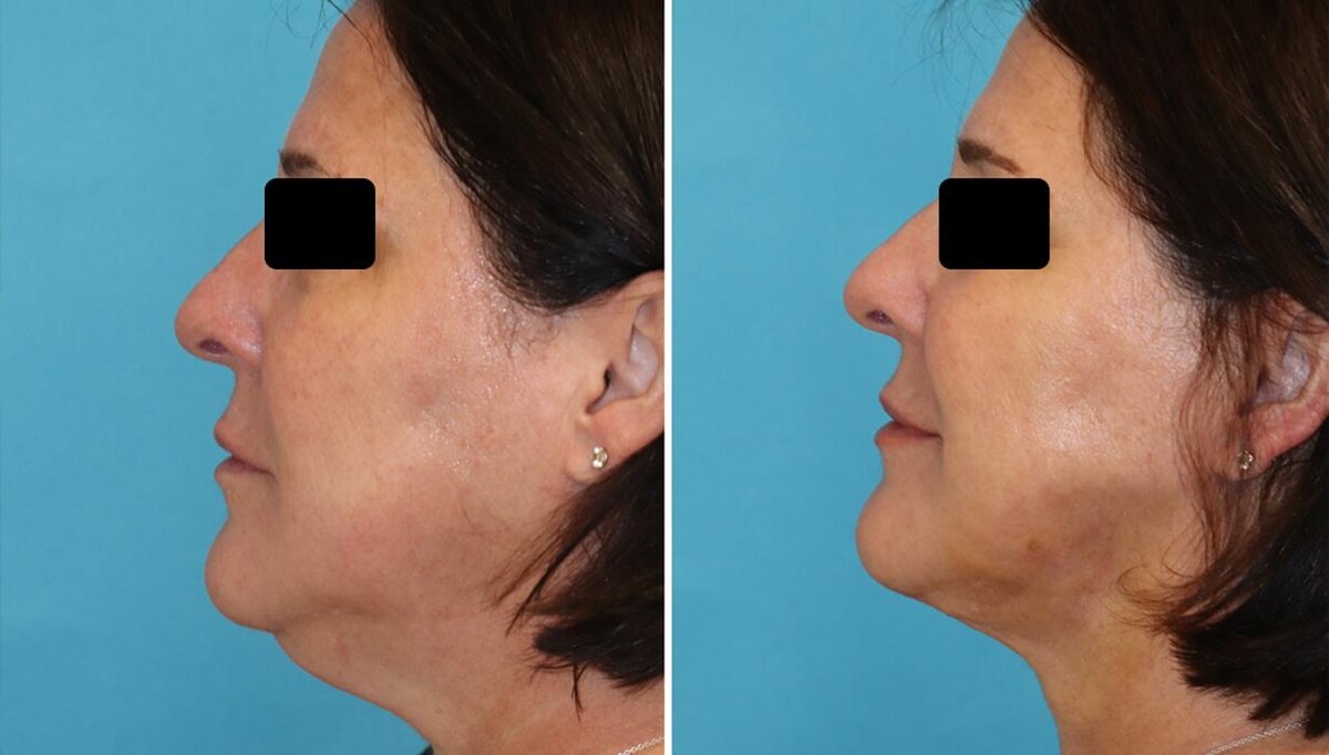 Images Eugenie Brunner, MD, FACS