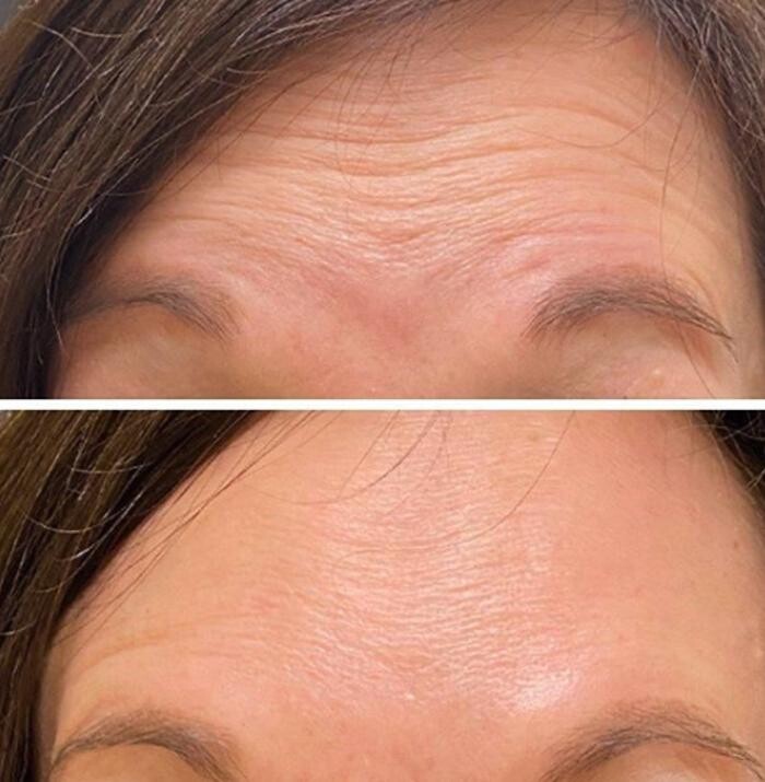 Images Eugenie Brunner, MD, FACS