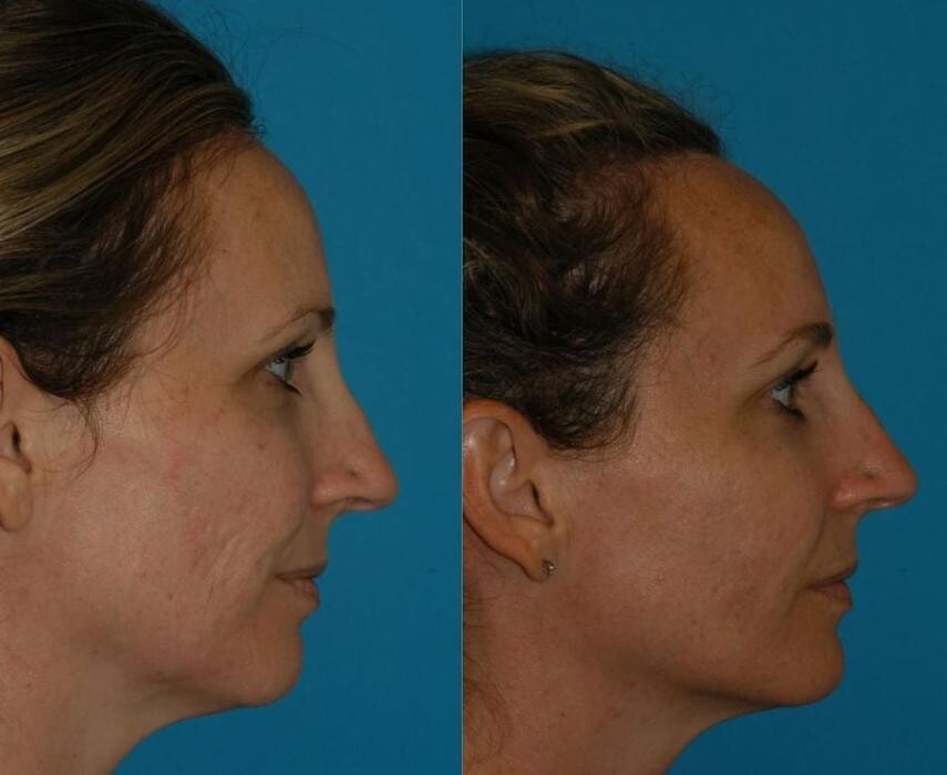 Images Eugenie Brunner, MD, FACS