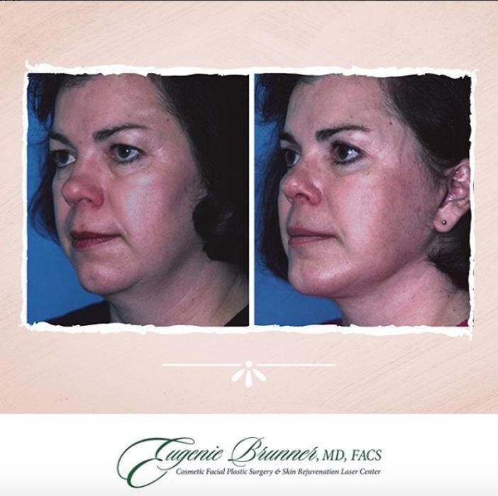 Images Eugenie Brunner, MD, FACS