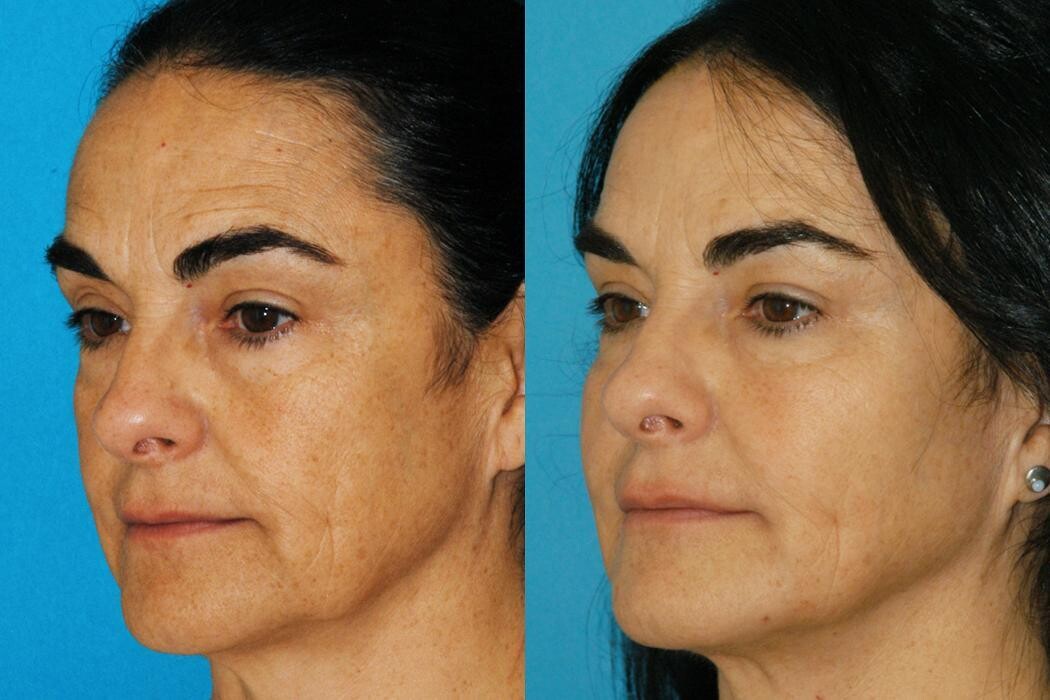 Images Eugenie Brunner, MD, FACS