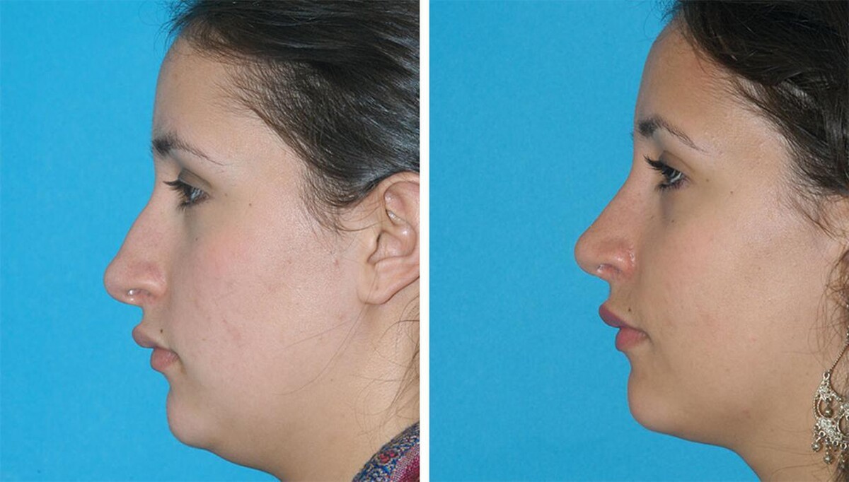 Images Eugenie Brunner, MD, FACS