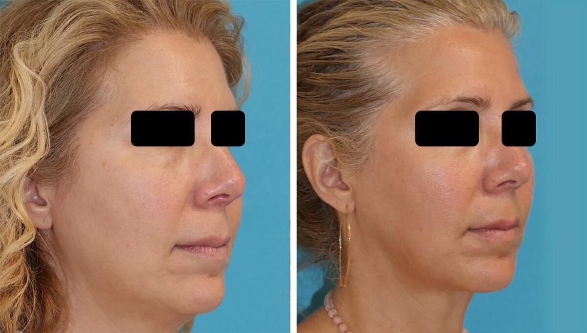 Images Eugenie Brunner, MD, FACS