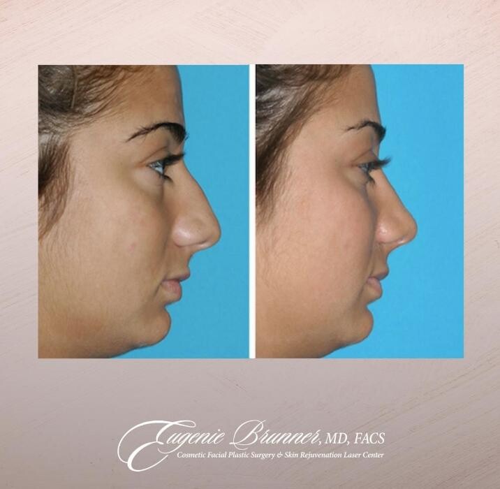 Images Eugenie Brunner, MD, FACS