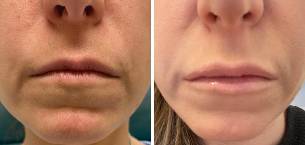 Images Eugenie Brunner, MD, FACS