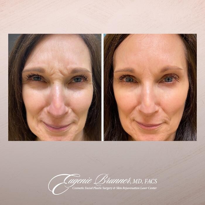 Images Eugenie Brunner, MD, FACS