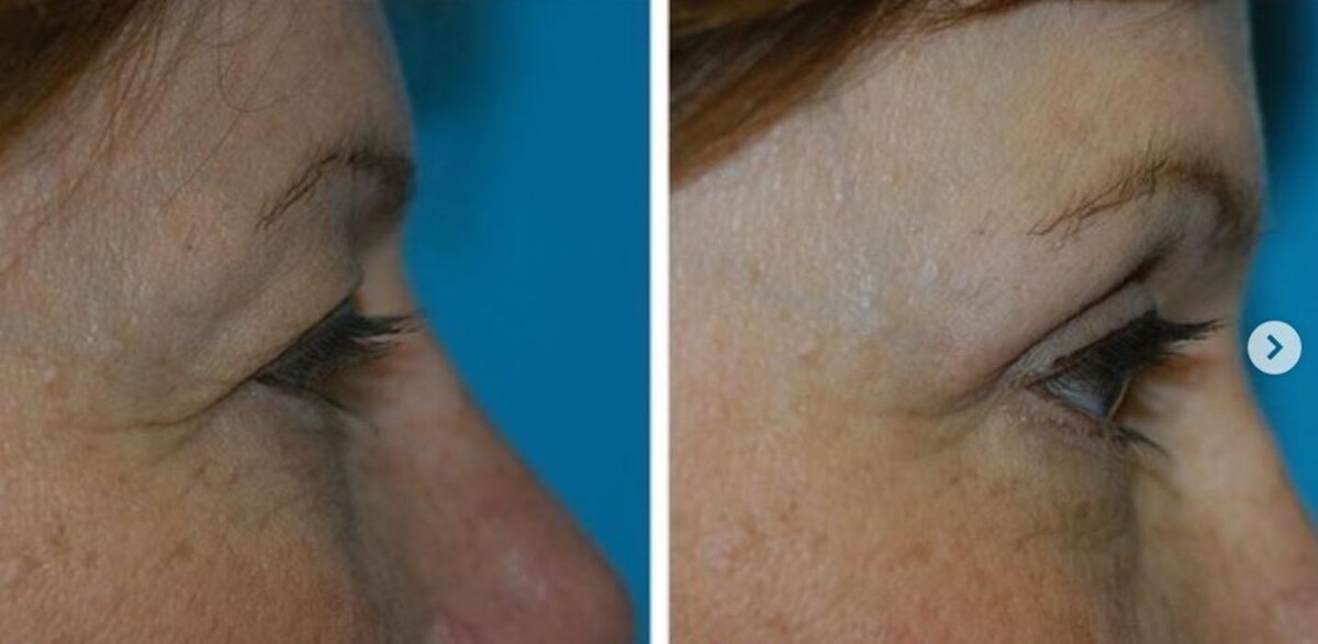 Images Eugenie Brunner, MD, FACS