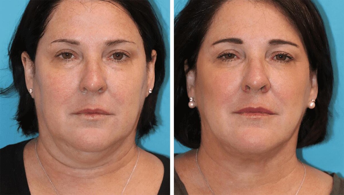 Images Eugenie Brunner, MD, FACS