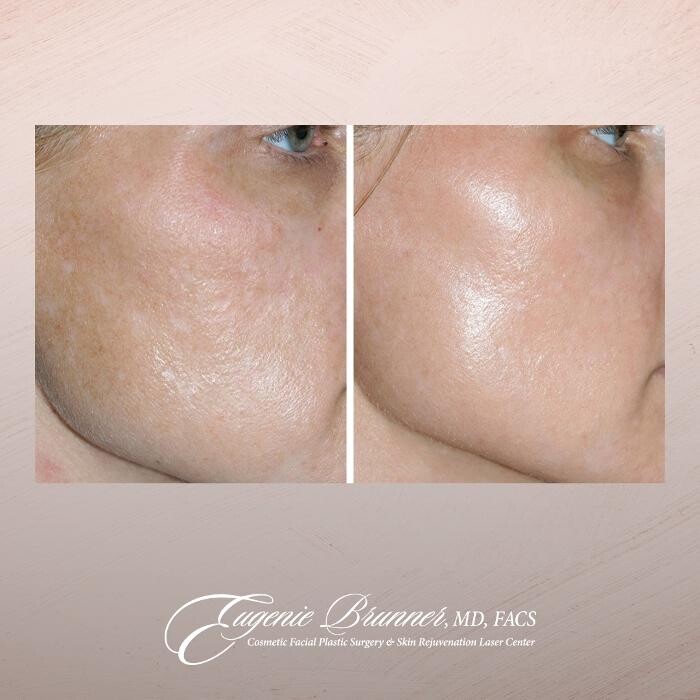 Images Eugenie Brunner, MD, FACS