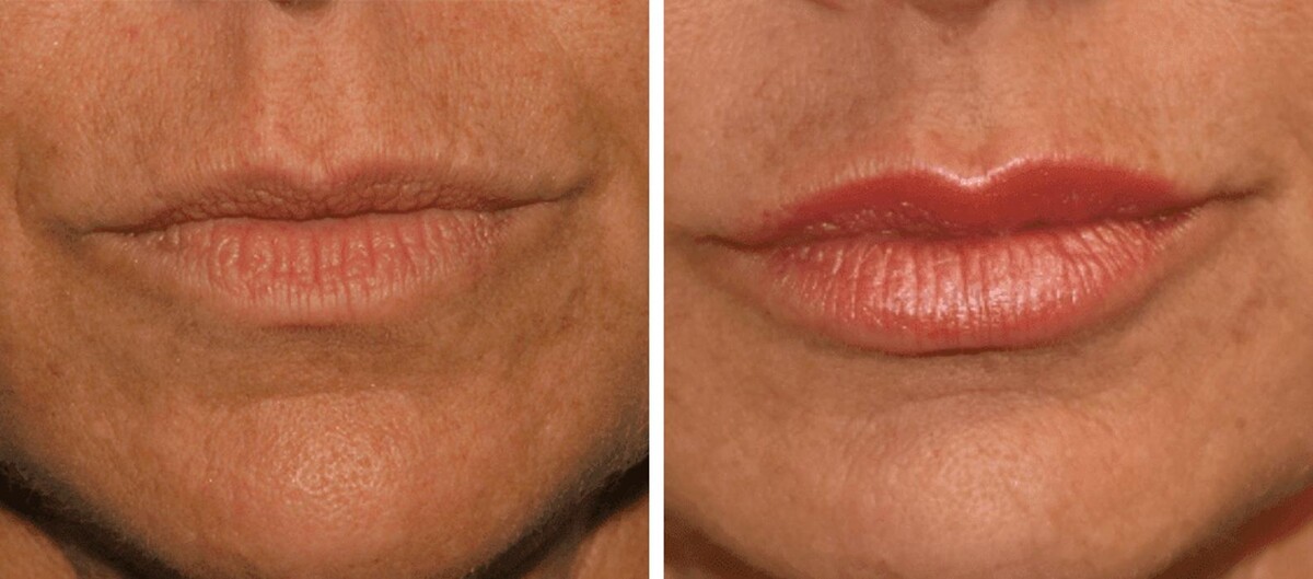 Images Eugenie Brunner, MD, FACS