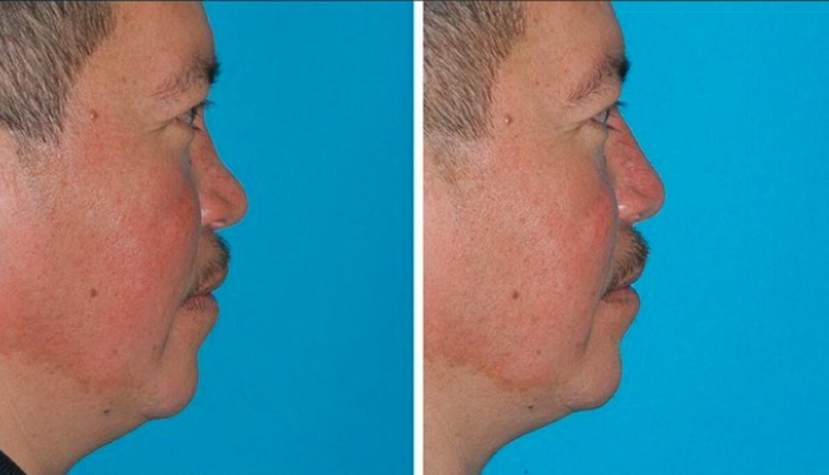 Images Eugenie Brunner, MD, FACS