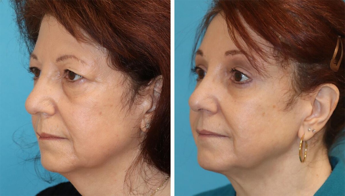 Images Eugenie Brunner, MD, FACS