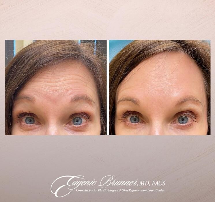 Images Eugenie Brunner, MD, FACS