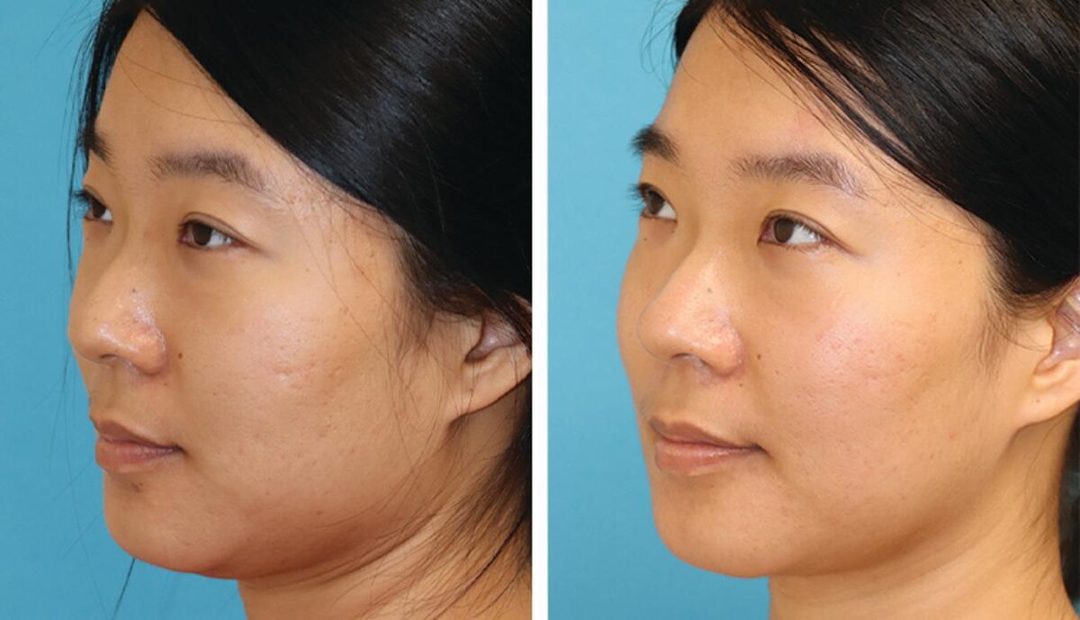 Images Eugenie Brunner, MD, FACS