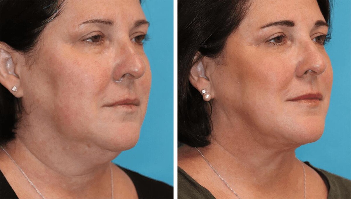 Images Eugenie Brunner, MD, FACS