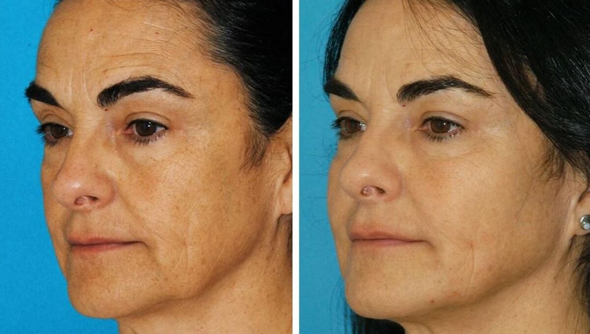 Images Eugenie Brunner, MD, FACS