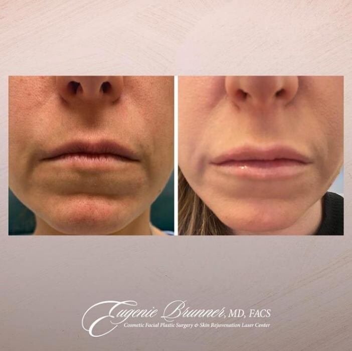 Images Eugenie Brunner, MD, FACS