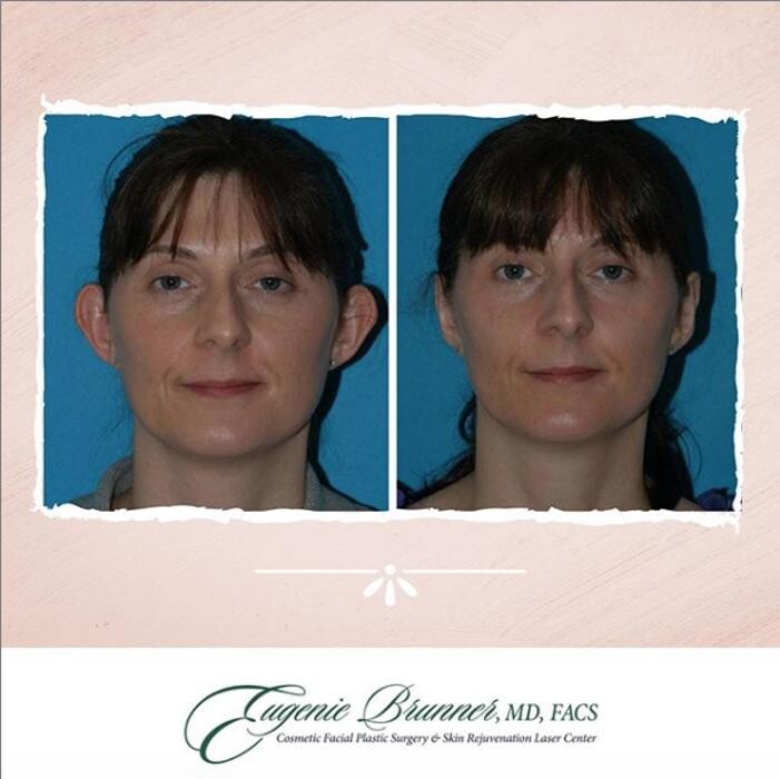 Images Eugenie Brunner, MD, FACS