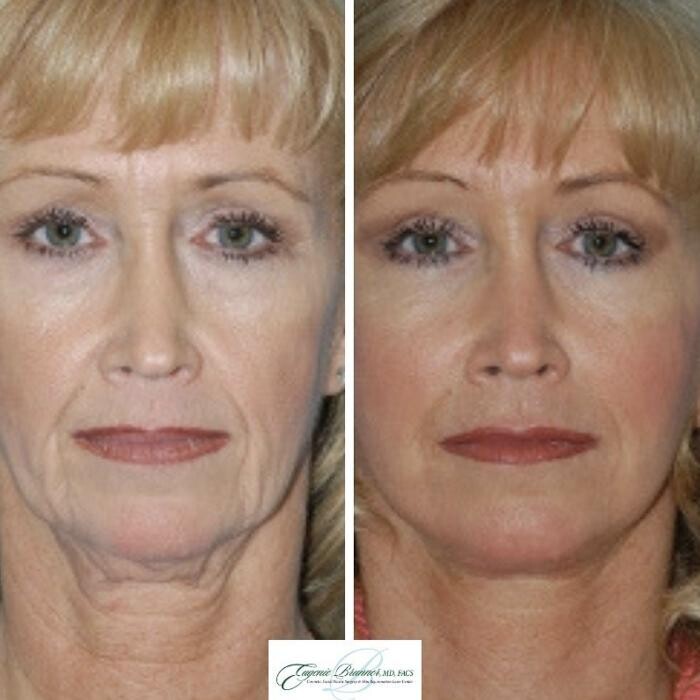 Images Eugenie Brunner, MD, FACS