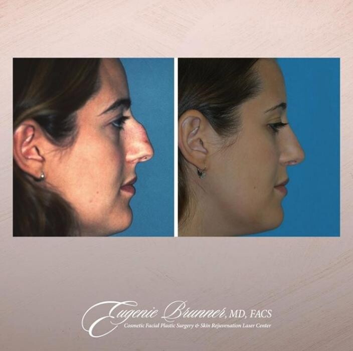 Images Eugenie Brunner, MD, FACS