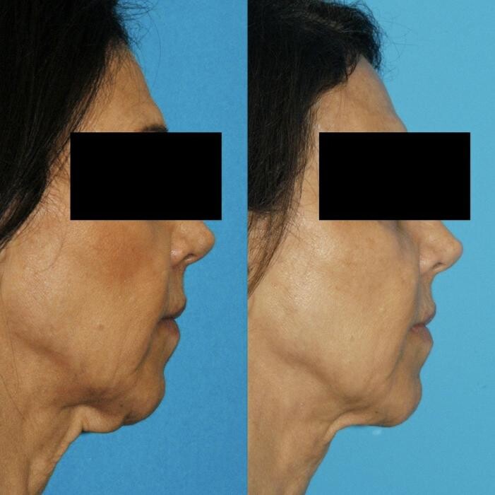 Images Eugenie Brunner, MD, FACS