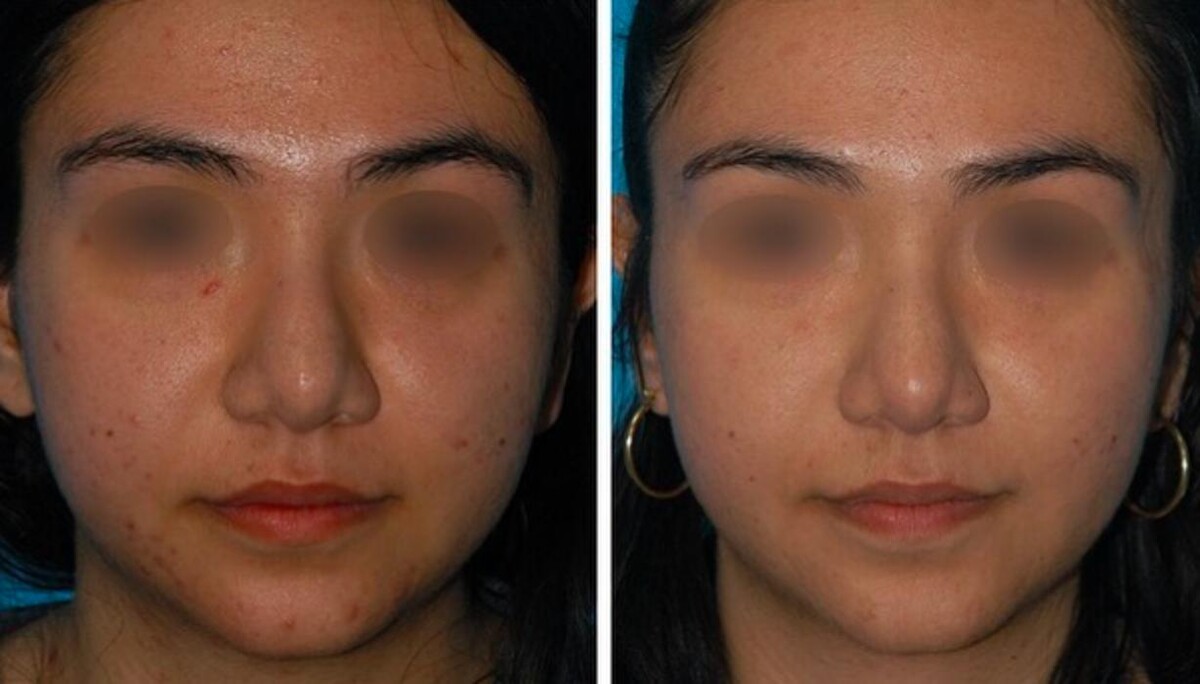 Images Eugenie Brunner, MD, FACS