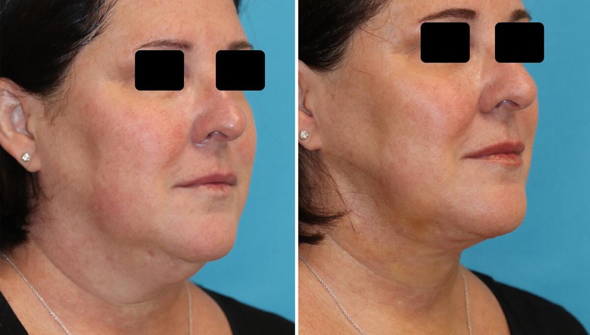 Images Eugenie Brunner, MD, FACS