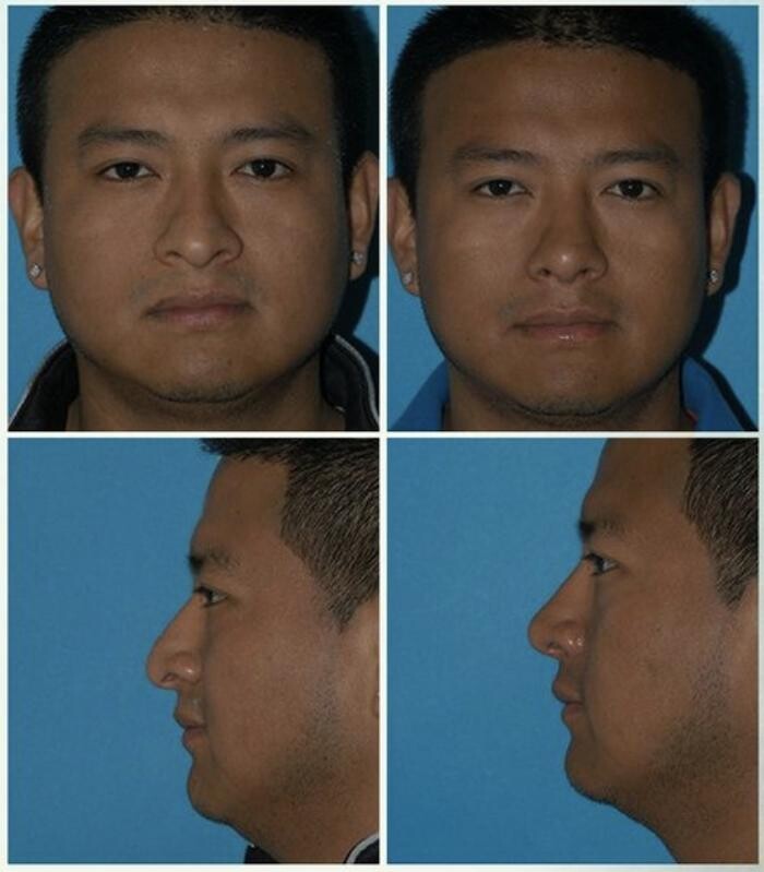 Images Eugenie Brunner, MD, FACS