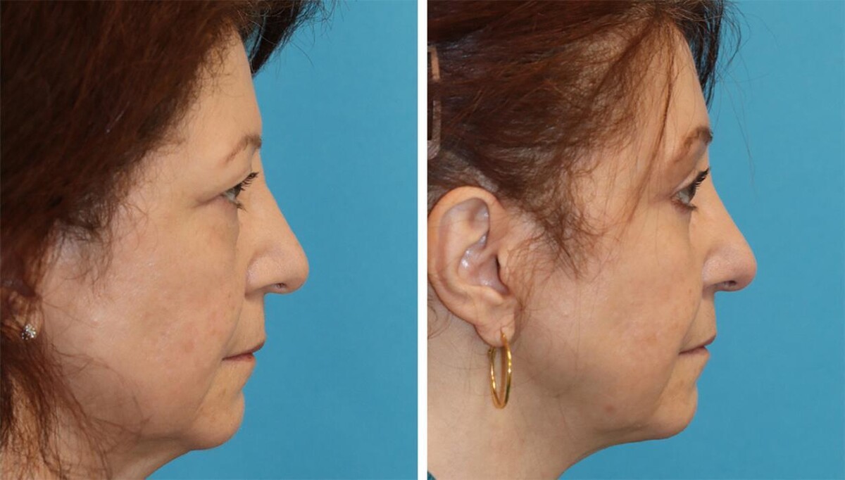 Images Eugenie Brunner, MD, FACS