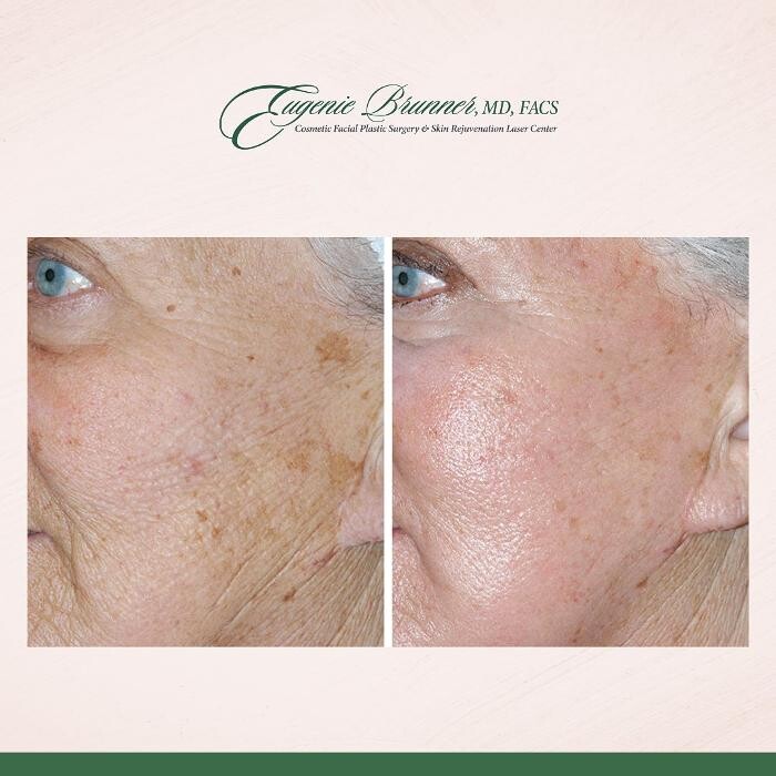 Images Eugenie Brunner, MD, FACS