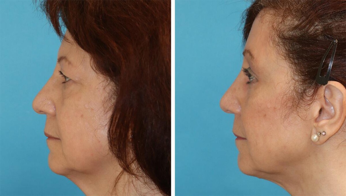 Images Eugenie Brunner, MD, FACS