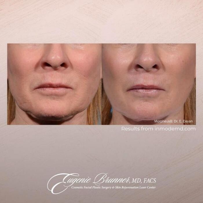 Images Eugenie Brunner, MD, FACS